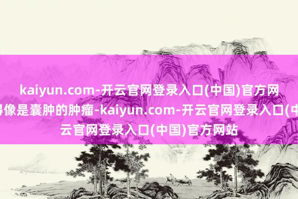 kaiyun.com-开云官网登录入口(中国)官方网站或者是长得像是囊肿的肿瘤-kaiyun.com-开云官网登录入口(中国)官方网站